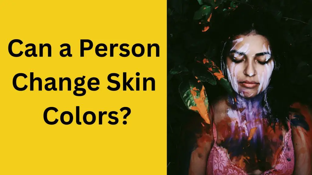Can a Person Change Skin Colors?