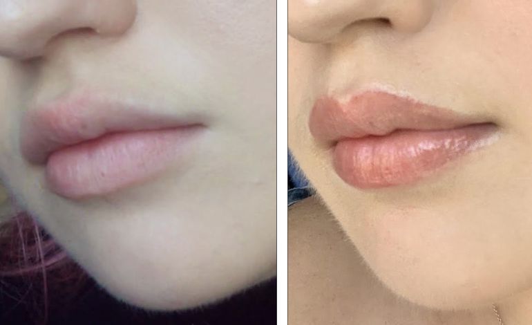 lip blush before and after
