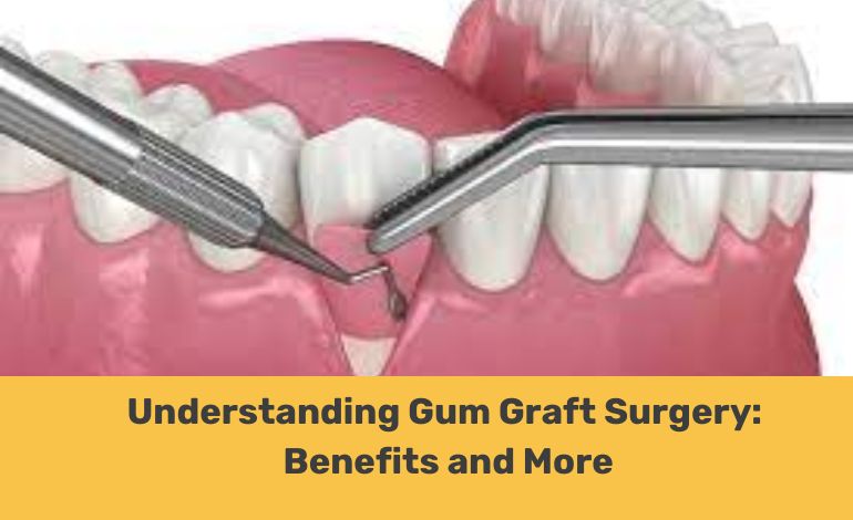Gum graft