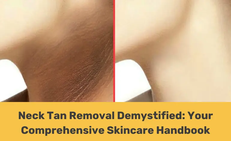 neck tan removal