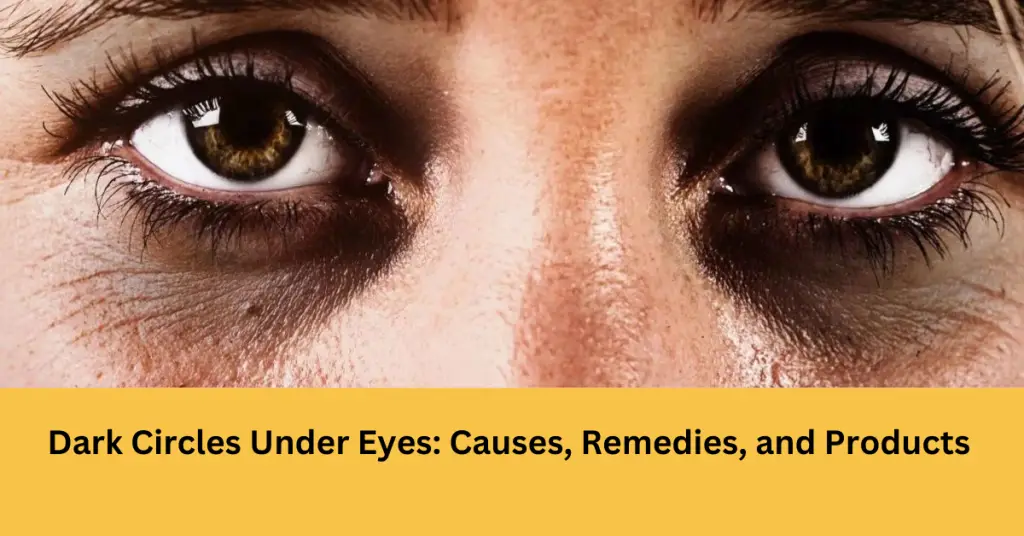 Dark circles under eyes